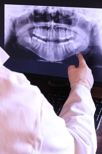 Best Emergency Dental Extractions in Perry Hall, MD