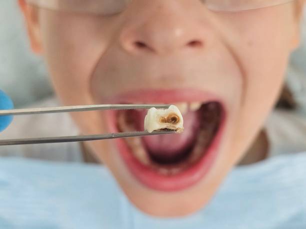 Best Emergency Cosmetic Dentistry in Perry Hall, MD